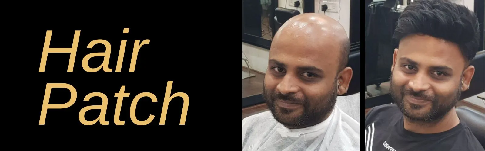 hair-patch-in-delhi
