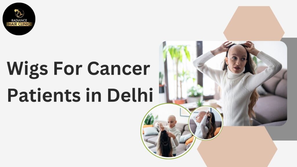 Wigs For Cancer Patients in Delhi